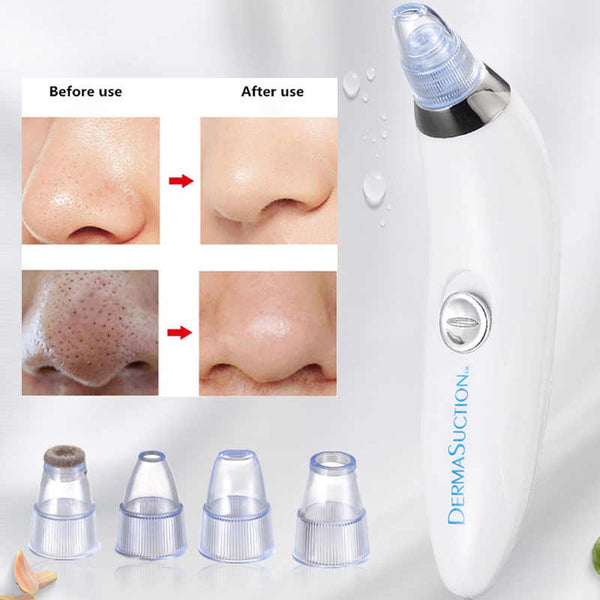 Derma Suction Blackhead Remover Machine